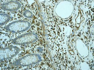 Immunohistochemistry (Formalin/PFA-fixed paraffin-embedded sections) - Anti-muscle Actin antibody [EPR4791] - BSA and Azide free (AB247880), expandable thumbnail