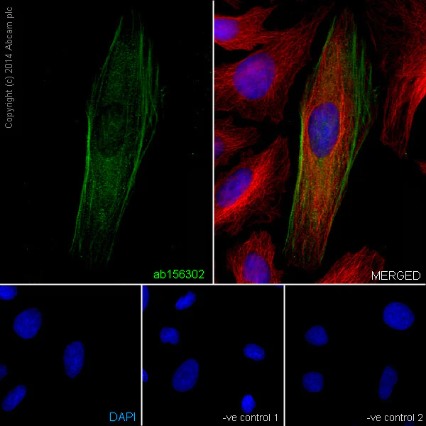 Immunocytochemistry/ Immunofluorescence - Anti-muscle Actin antibody [EPR8484] - Loading Control (AB156302)