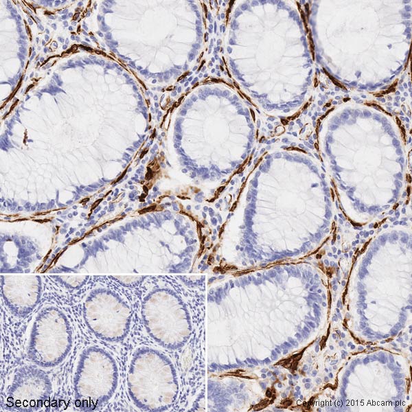 Immunohistochemistry (Formalin/PFA-fixed paraffin-embedded sections) - Anti-muscle Actin antibody [EPR8484] - Loading Control (ab156302), expandable thumbnail