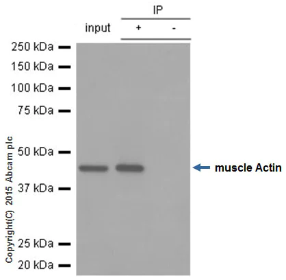 Immunoprecipitation - Anti-muscle Actin antibody [EPR8484] - Loading Control (AB156302)