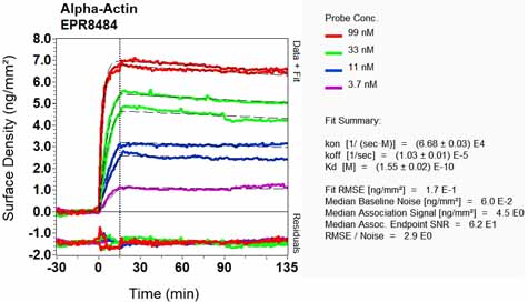 OI-RD Scanning - Anti-muscle Actin antibody [EPR8484] - Loading Control (ab156302), expandable thumbnail
