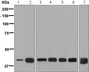 Western blot - Anti-muscle Actin antibody [EPR8484] - Loading Control (AB156302)