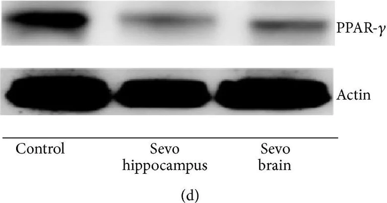 Western blot - Anti-muscle Actin antibody [EPR8484] - Loading Control (AB156302)