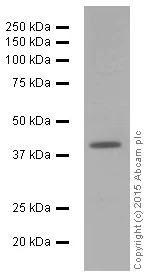 Western blot - Anti-muscle Actin antibody [EPR8484] - Loading Control (AB156302)