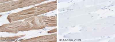 Immunohistochemistry (Formalin/PFA-fixed paraffin-embedded sections) - Anti-muscle Actin antibody [HHF35] - Cytoskeleton Marker (AB7813)
