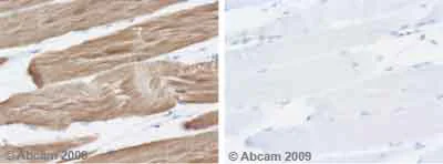 Immunohistochemistry (Formalin/PFA-fixed paraffin-embedded sections) - Anti-muscle Actin antibody [HHF35] - Cytoskeleton Marker (AB7813)
