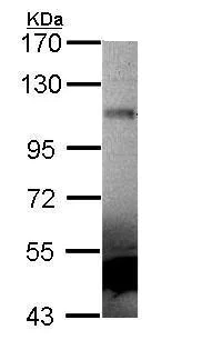Western blot - Anti-MUSK antibody - N-terminal (AB228488)