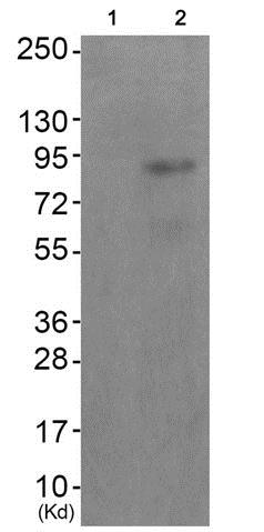 Western blot - Anti-MUSK (phospho Y755) antibody (AB192583)
