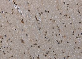 Immunohistochemistry (Formalin/PFA-fixed paraffin-embedded sections) - Anti-MVD antibody (AB198823), expandable thumbnail