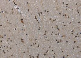 Immunohistochemistry (Formalin/PFA-fixed paraffin-embedded sections) - Anti-MVD antibody (AB198823)