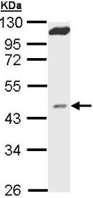 Western blot - Anti-MVD antibody (AB96226), expandable thumbnail