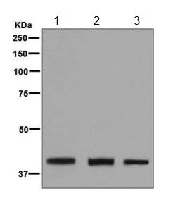 Western blot - Anti-MVD antibody [EPR6559(2)] (AB129061)