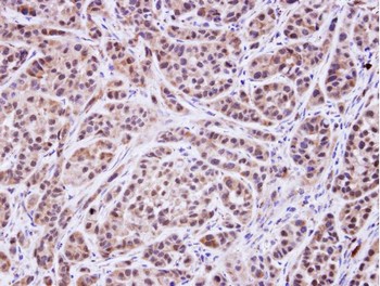 Immunohistochemistry (Formalin/PFA-fixed paraffin-embedded sections) - Anti-MVK antibody (AB154515)