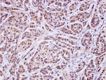 Immunohistochemistry (Formalin/PFA-fixed paraffin-embedded sections) - Anti-MVK antibody (AB154515)