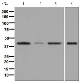 Western blot - Anti-MVK antibody [EPR6507] (AB126619)