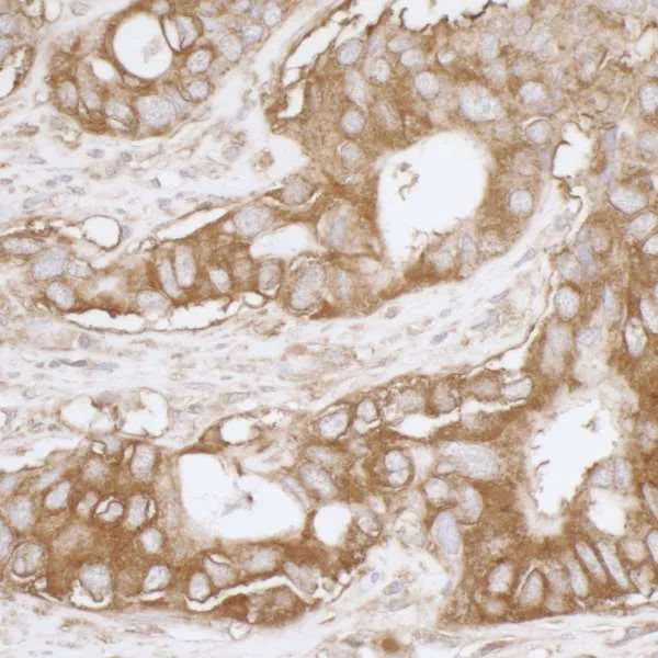 Immunohistochemistry (Formalin/PFA-fixed paraffin-embedded sections) - Anti-MVP antibody (AB226248)