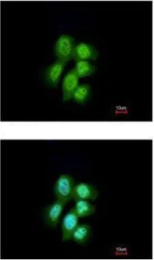 Immunocytochemistry/ Immunofluorescence - Anti-MVP antibody (AB97311)