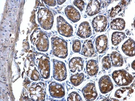 Immunohistochemistry (Formalin/PFA-fixed paraffin-embedded sections) - Anti-MVP antibody (ab97311), expandable thumbnail