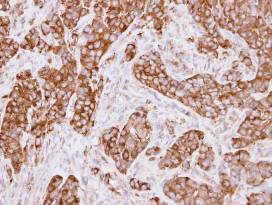 Immunohistochemistry (Formalin/PFA-fixed paraffin-embedded sections) - Anti-MVP antibody (AB97311), expandable thumbnail