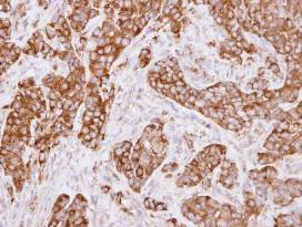Immunohistochemistry (Formalin/PFA-fixed paraffin-embedded sections) - Anti-MVP antibody (AB97311)