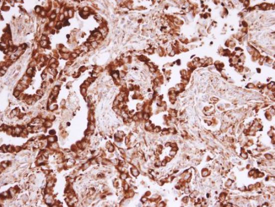 Immunohistochemistry (Formalin/PFA-fixed paraffin-embedded sections) - Anti-MVP antibody (ab97311), expandable thumbnail