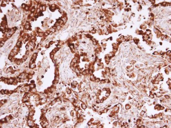 Immunohistochemistry (Formalin/PFA-fixed paraffin-embedded sections) - Anti-MVP antibody (AB97311)