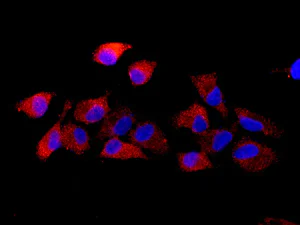 Immunocytochemistry/ Immunofluorescence - Anti-MVP antibody [EPR13227(B)] (AB175239)