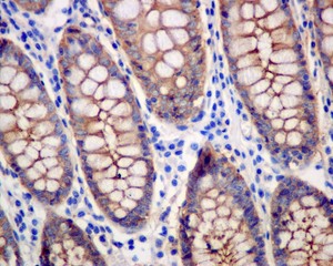 Immunohistochemistry (Formalin/PFA-fixed paraffin-embedded sections) - Anti-MVP antibody [EPR13227(B)] - BSA and Azide free (ab240184), expandable thumbnail