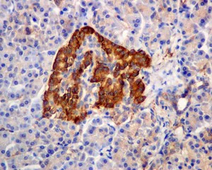 Immunohistochemistry (Formalin/PFA-fixed paraffin-embedded sections) - Anti-MVP antibody [EPR13227(B)] - BSA and Azide free (AB240184)