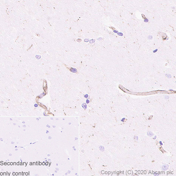 Immunohistochemistry (Formalin/PFA-fixed paraffin-embedded sections) - Anti-MVP antibody [EPR23594-106] - BSA and Azide free (ab273097), expandable thumbnail