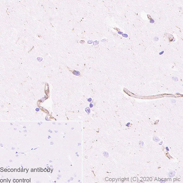 Immunohistochemistry (Formalin/PFA-fixed paraffin-embedded sections) - Anti-MVP antibody [EPR23594-106] - BSA and Azide free (AB273097)
