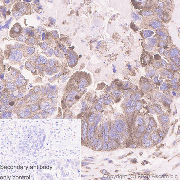 Immunohistochemistry (Formalin/PFA-fixed paraffin-embedded sections) - Anti-MVP antibody [EPR23594-106] - BSA and Azide free (AB273097), expandable thumbnail