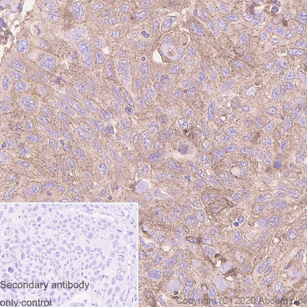 Immunohistochemistry (Formalin/PFA-fixed paraffin-embedded sections) - Anti-MVP antibody [EPR23594-106] - BSA and Azide free (ab273097), expandable thumbnail