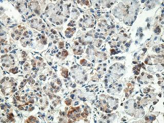 Immunohistochemistry (Formalin/PFA-fixed paraffin-embedded sections) - Anti-MX1 antibody (AB197205), expandable thumbnail