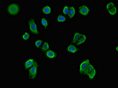 Immunocytochemistry/ Immunofluorescence - Anti-MX1 antibody (AB222856), expandable thumbnail