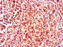Immunohistochemistry (Formalin/PFA-fixed paraffin-embedded sections) - Anti-MX1 antibody (AB222856), expandable thumbnail
