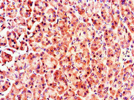Immunohistochemistry (Formalin/PFA-fixed paraffin-embedded sections) - Anti-MX1 antibody (AB222856)