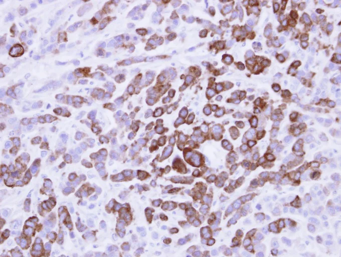 Immunohistochemistry (Formalin/PFA-fixed paraffin-embedded sections) - Anti-MX1 antibody (AB95926)