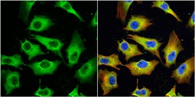 Immunocytochemistry/ Immunofluorescence - Anti-MX1 antibody (AB97921)