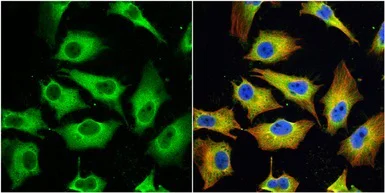 Immunocytochemistry/ Immunofluorescence - Anti-MX1 antibody (AB97921)