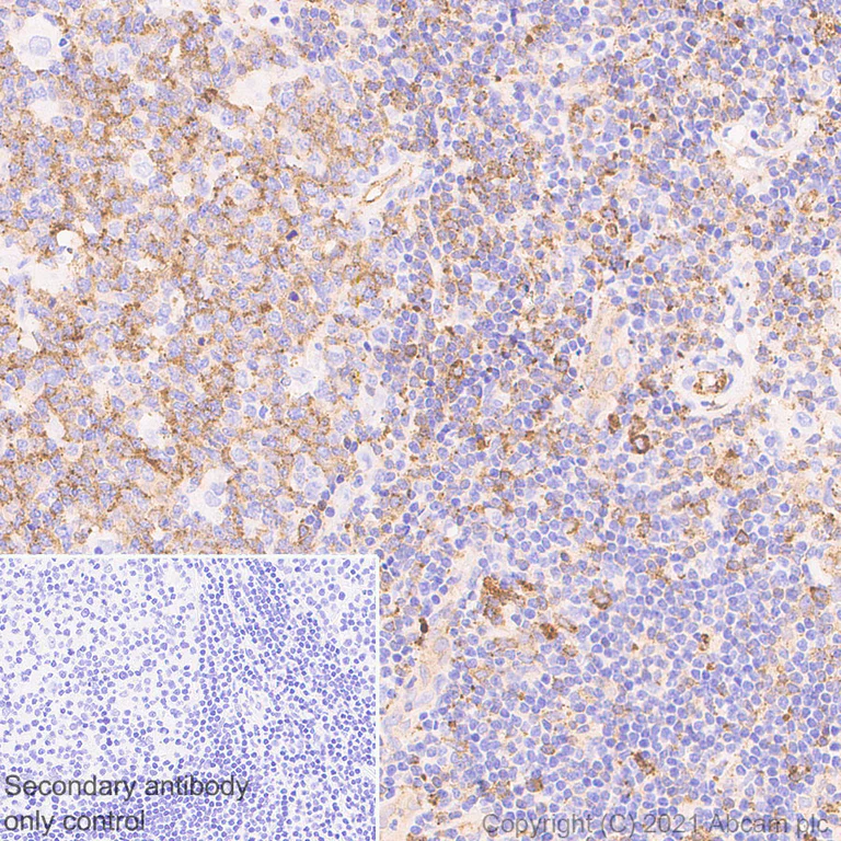 Immunohistochemistry (Formalin/PFA-fixed paraffin-embedded sections) - Anti-MX1 antibody [EPR24485-19] (AB284603)