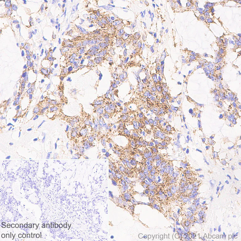 Immunohistochemistry (Formalin/PFA-fixed paraffin-embedded sections) - Anti-MX1 antibody [EPR24485-19] (AB284603)