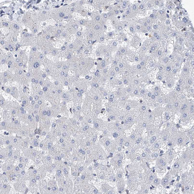 Immunohistochemistry (Formalin/PFA-fixed paraffin-embedded sections) - Anti-MX2 antibody (AB224479), expandable thumbnail