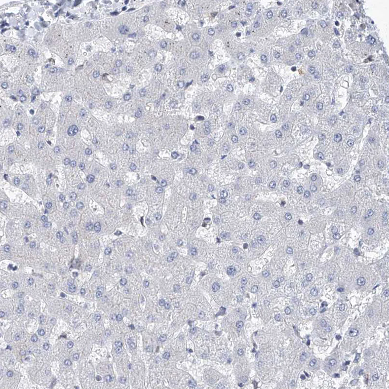 Immunohistochemistry (Formalin/PFA-fixed paraffin-embedded sections) - Anti-MX2 antibody (AB224479)
