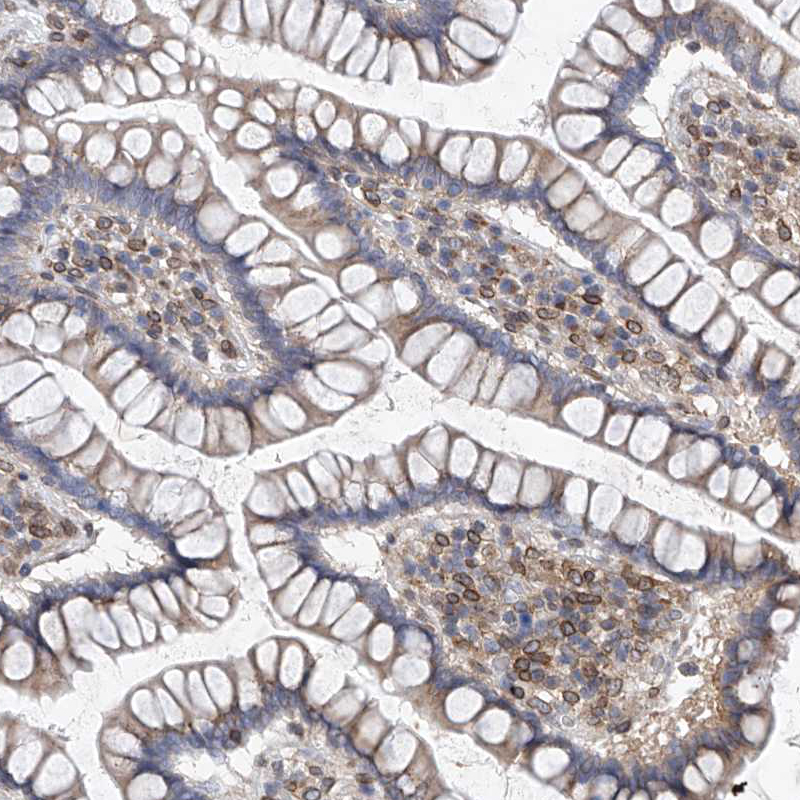 Immunohistochemistry (Formalin/PFA-fixed paraffin-embedded sections) - Anti-MX2 antibody (AB224479), expandable thumbnail