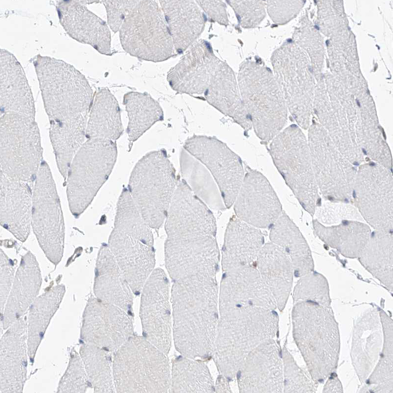 Immunohistochemistry (Formalin/PFA-fixed paraffin-embedded sections) - Anti-MX2 antibody (AB224479), expandable thumbnail