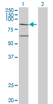 Western blot - Anti-MX2 antibody (AB67388), expandable thumbnail