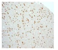 Immunohistochemistry (Formalin/PFA-fixed paraffin-embedded sections) - Anti-MXD3/MAD3 antibody [EPR3882] (AB108525)