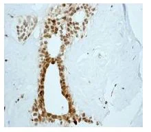 Immunohistochemistry (Formalin/PFA-fixed paraffin-embedded sections) - Anti-MXD3/MAD3 antibody [EPR3882] (AB108525)