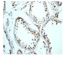 Immunohistochemistry (Formalin/PFA-fixed paraffin-embedded sections) - Anti-MXD3/MAD3 antibody [EPR3882] (AB108525)